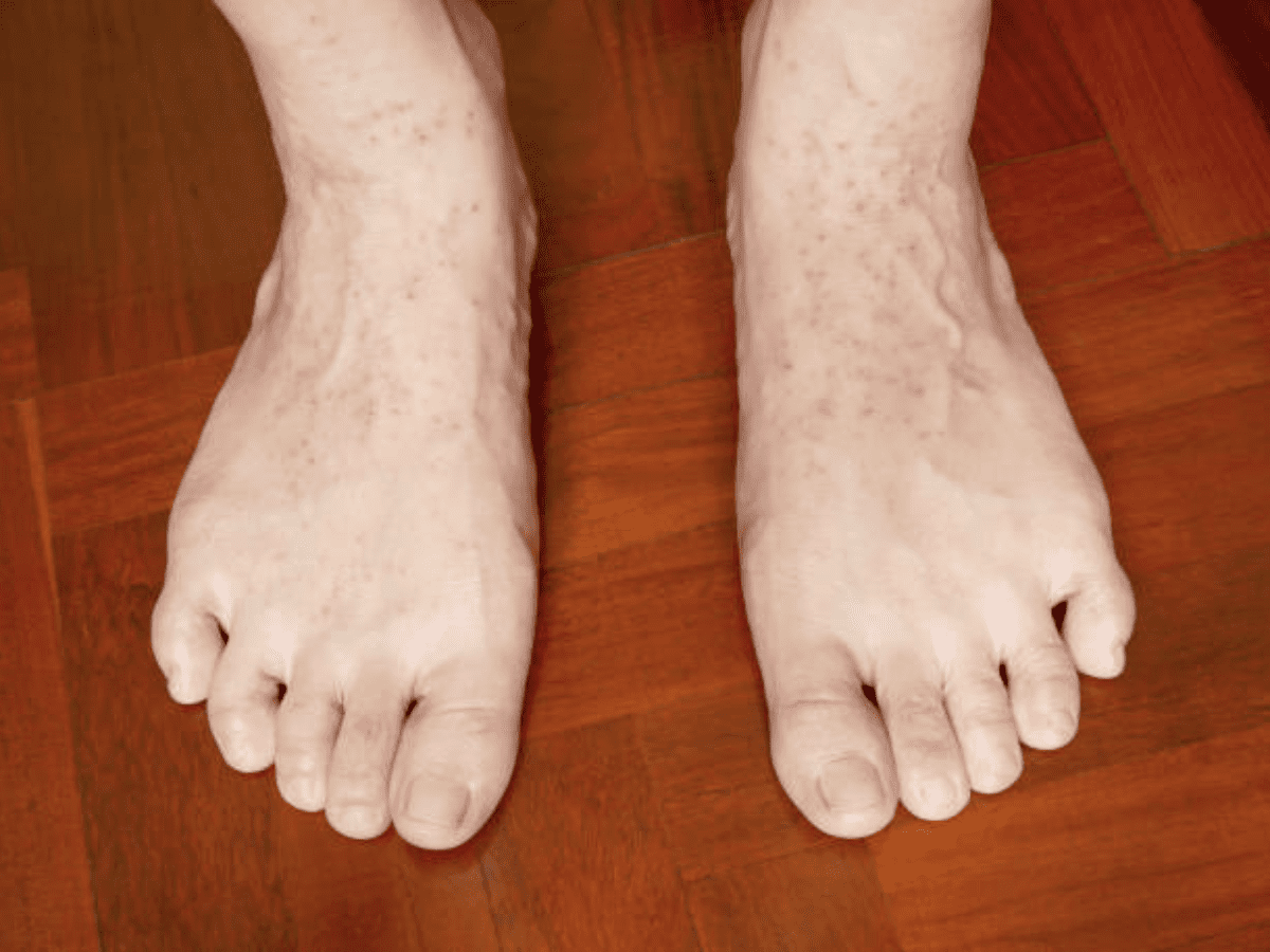 MH performance coaching helping overcome autoimmune challenges